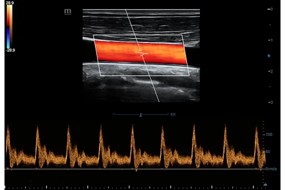 Клинические изображения УЗИ аппарат Mindray DC-45