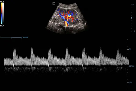 Клинические изображения УЗИ аппарат Mindray DC-45