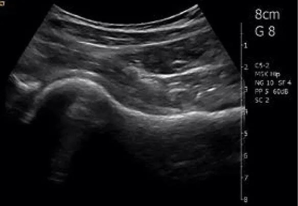 Клинические изображения Siemens Acuson Freestyle УЗИ аппарат портативный