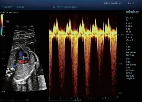 Клинические изображения УЗИ аппарат Mindray DC-80 Exp