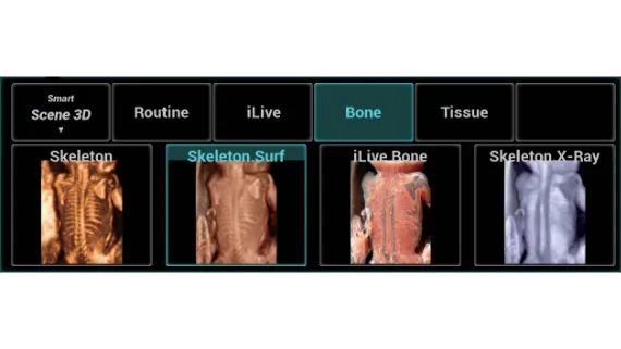 Клинические изображения УЗИ аппарат Mindray Imagyn I9