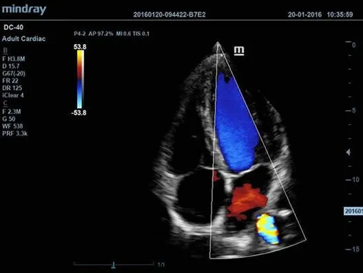 Клинические изображения УЗИ аппарат Mindray DC-40