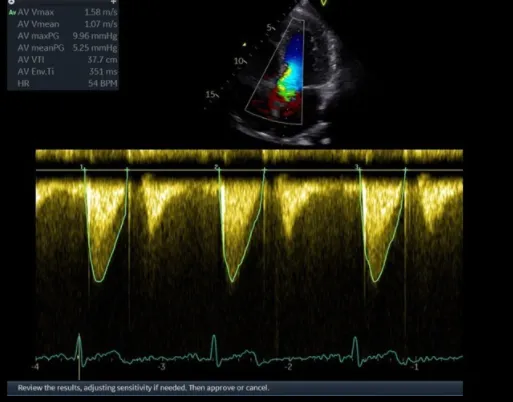 Клинические изображения GE HealthCare Vivid T9 аппарат ультразвуковой