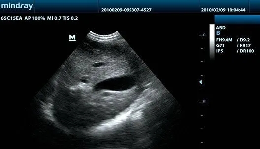 Клинические изображения УЗИ аппарат Mindray DP-30 Vet портативный ветеринарный