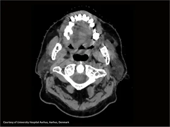 Клинические изображения Siemens SOMATOM go.Sim компьютерный томограф 