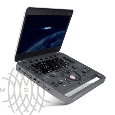 УЗИ аппарат SonoScape ProPet E11