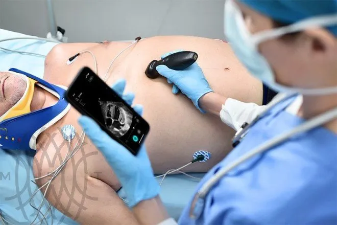 УЗИ аппарат Mindray TE Air