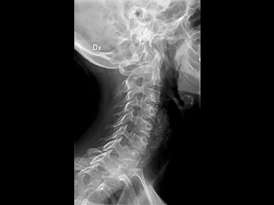 Клинические изображения Brivo XR575 цифровой рентгенографический аппарат GE HealthCare