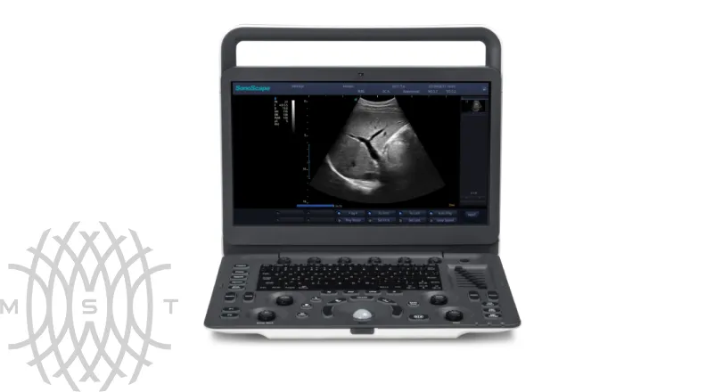 Sonoscape E3 ультразвуковой аппарат