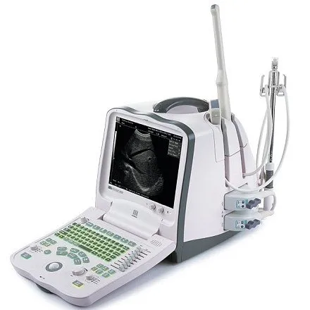 УЗИ аппарат Mindray DP-6900 портативный