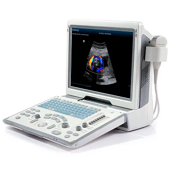 УЗИ аппарат Mindray DP-50 портативный