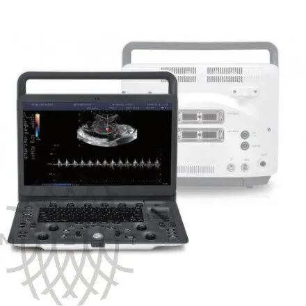 Sonoscape E2 ультразвуковой аппарат