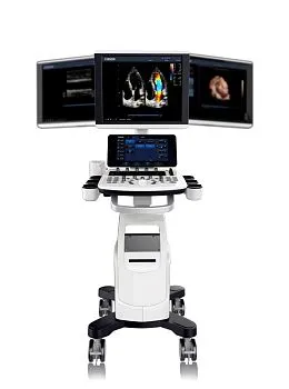 Ультразвуковой аппарат Chison Qbit 6