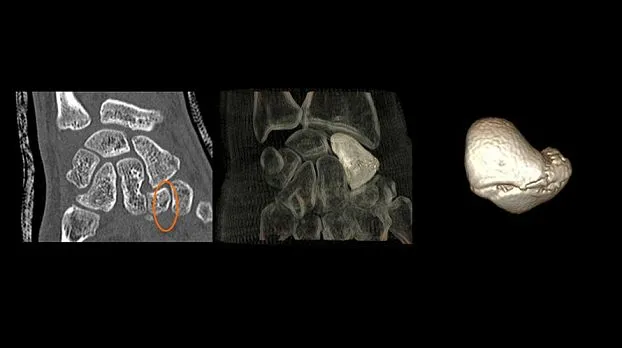 Клинические изображения GE Optima CT520 компьютерный томограф