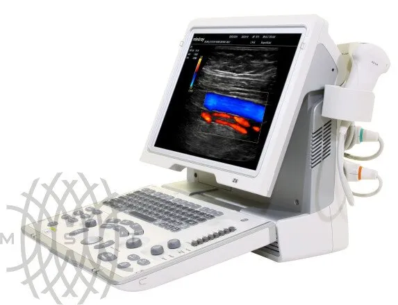 УЗИ аппарат Mindray Z6 портативный