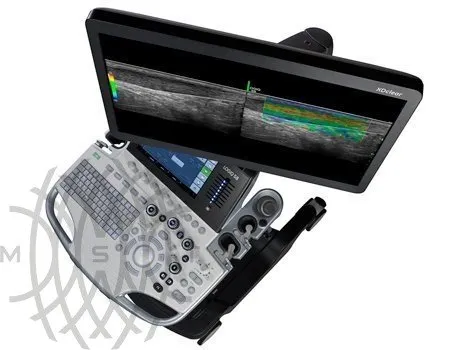 GE Logiq S8 XDclear ультразвуковая диагностическая система