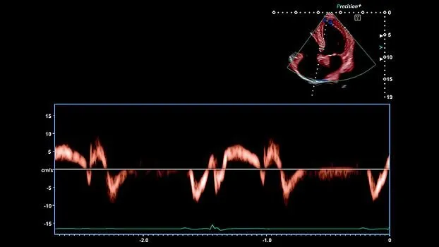 Клинические изображения Canon (Toshiba) Aplio i900 аппарат УЗИ