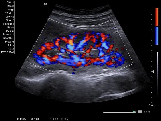 Клинические изображения Siemens Acuson NX2 Elite аппарат УЗИ
