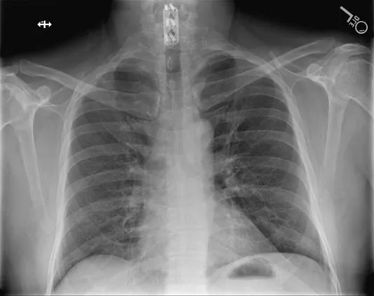 Клинические изображения Цифровой рентгеноcкопический аппарат Siemens Luminos Agile Max