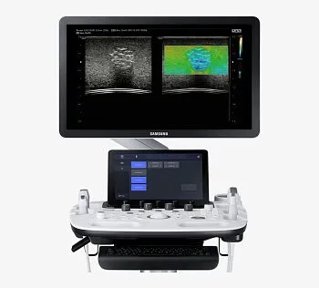 Samsung Medison HS40 УЗИ аппарат