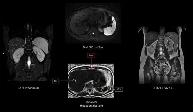 Клинические изображения МРТ аппарат GE SIGNA Voyager 1.5T