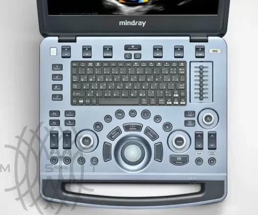 УЗИ аппарат Mindray M8 портативный