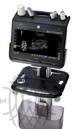 GE HealthCare Venue Go УЗИ аппарат портативный
