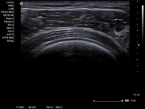 Клинические изображения Siemens Acuson NX2 Elite аппарат УЗИ