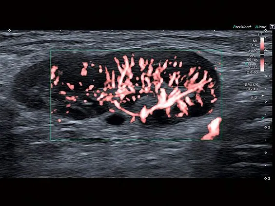 Клинические изображения Canon (Toshiba) Aplio a550 аппарат УЗИ