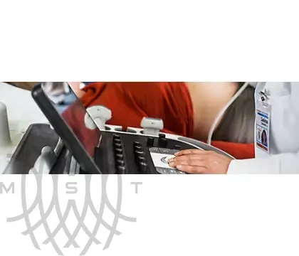 Philips EPIQ 7 ультразвуковой аппарат