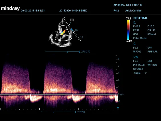 Клинические изображения УЗИ аппарат Mindray DC-55