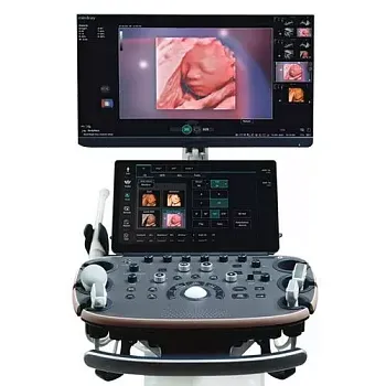 УЗИ аппарат Mindray Imagyn I9