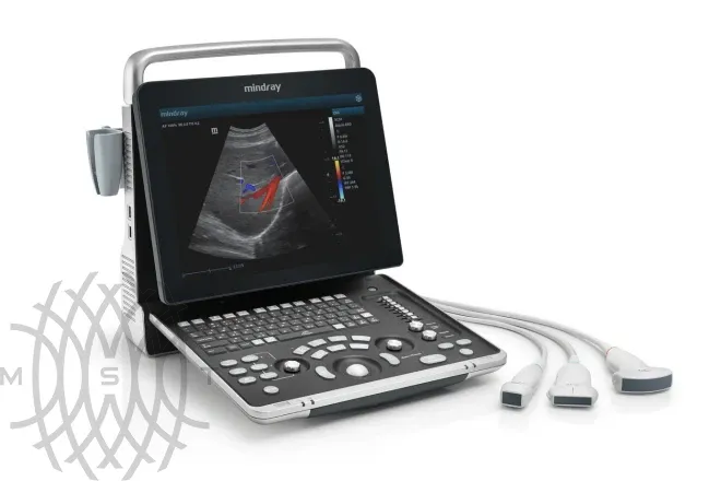 УЗИ аппарат Mindray Z60 Exp портативный