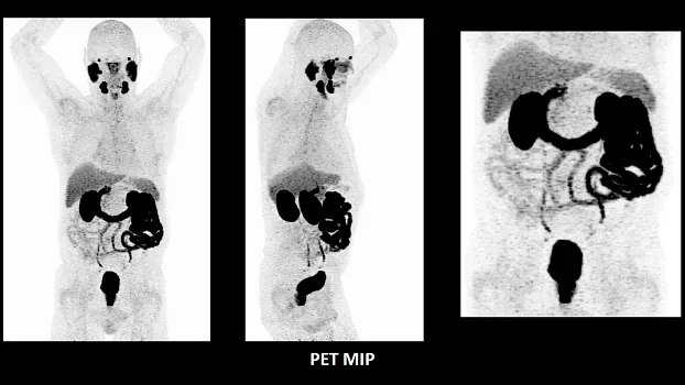 Клинические изображения Siemens Biograph Vision ПЭТ-КТ