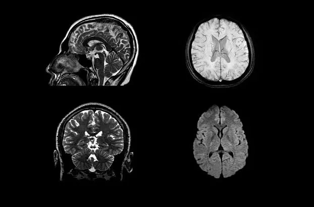 Клинические изображения МРТ аппарат GE SIGNA Creator 1.5T