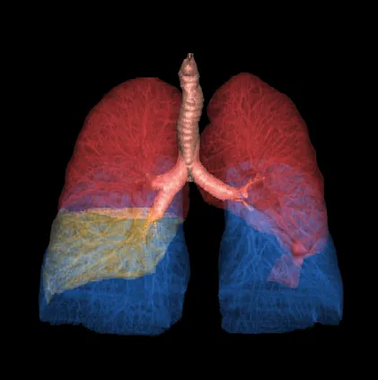 Клинические изображения Компьютерный томограф GE Optima CT540