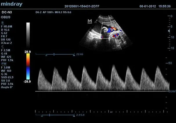 Клинические изображения УЗИ аппарат Mindray DC-N3