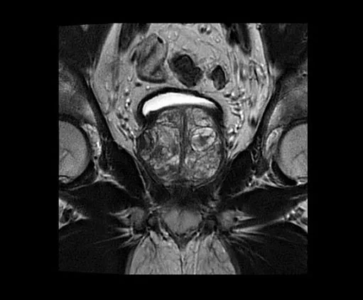 Клинические изображения МРТ аппарат GE SIGNA Architect 3T