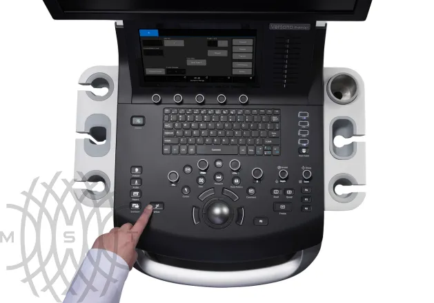 Ультразвуковая система GE Versana Premier Black