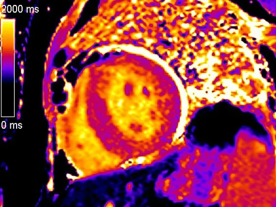 Клинические изображения Магнитно-резонансный томограф Siemens MAGNETOM Aera 1.5T