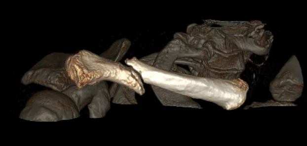 Клинические изображения Компьютерный томограф GE Optima CT540