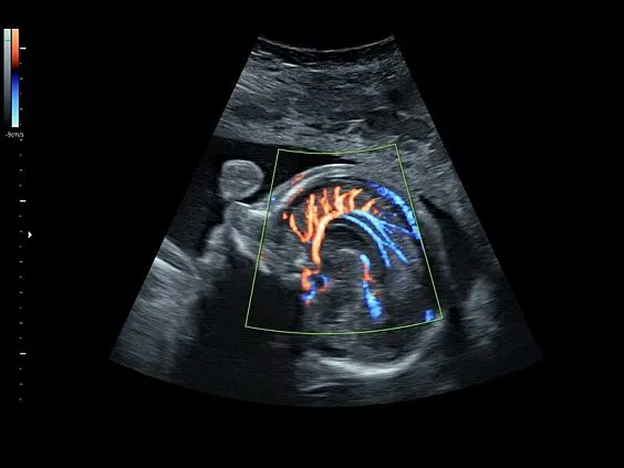 Клинические изображения GE Voluson S8 ультразвуковой аппарат