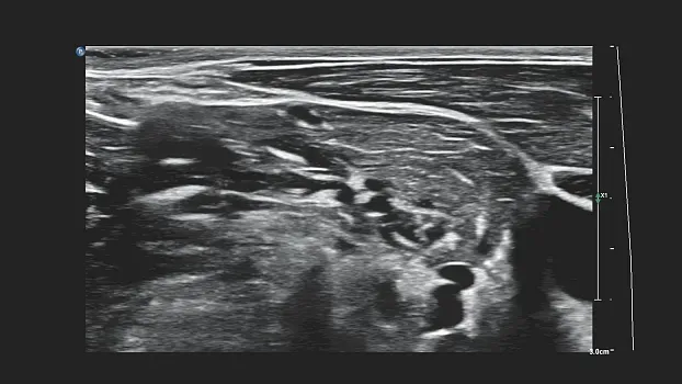 Клинические изображения Philips 5500 ультразвуковой аппарат портативный