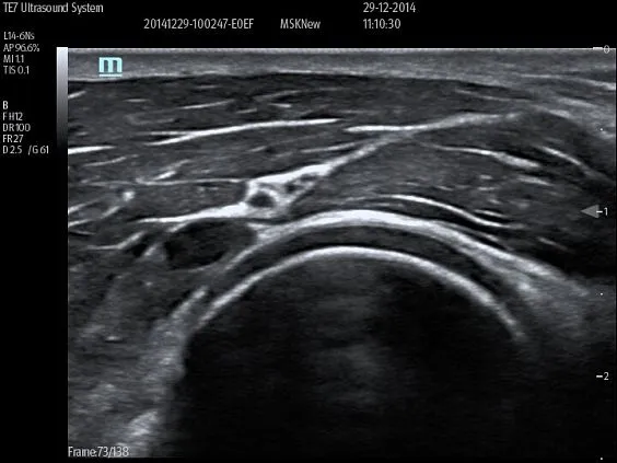 Клинические изображения УЗИ аппарат Mindray TE7 портативный