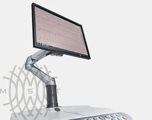 Cтресс-система CASE