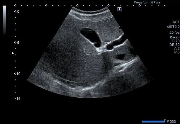 Клинические изображения Canon Xario 100 ультразвуковой аппарат