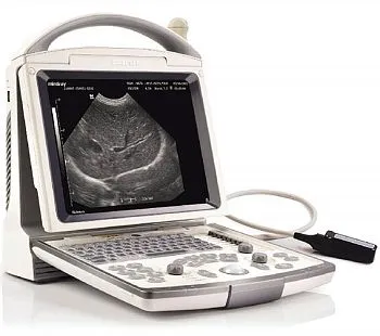 УЗИ аппарат Mindray DP-30 Vet портативный ветеринарный