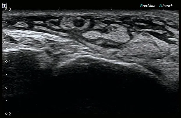 Клинические изображения Canon (Toshiba) Aplio 300 УЗИ аппарат
