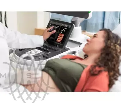 Philips EPIQ Elite ультразвуковой аппарат