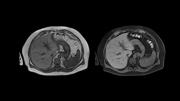 Клинические изображения Магнитно-резонансный томограф Siemens MAGNETOM Free.Max